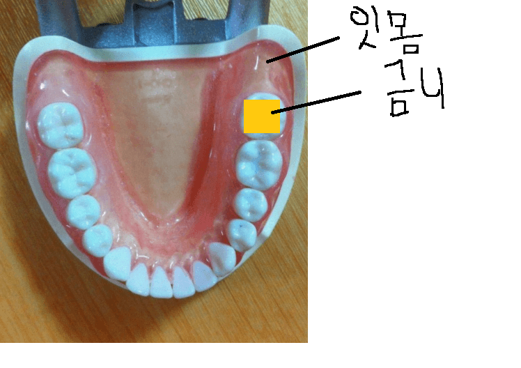 1번 째 사진