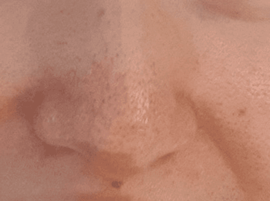 7번 째 사진