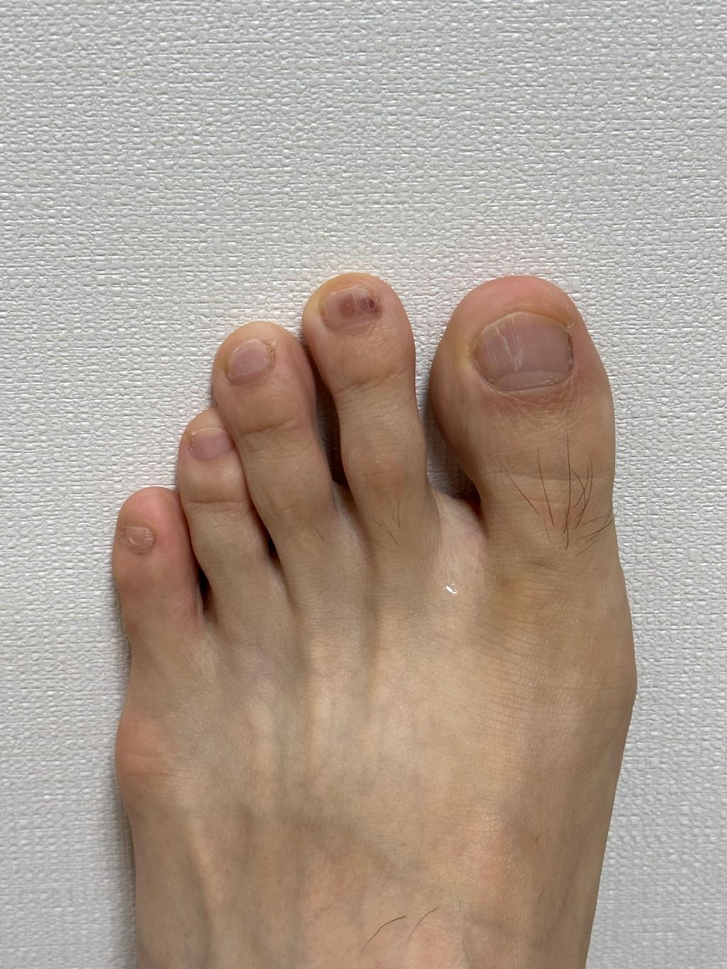 2번 째 사진