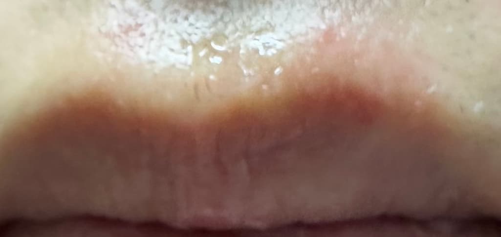 3번 째 사진