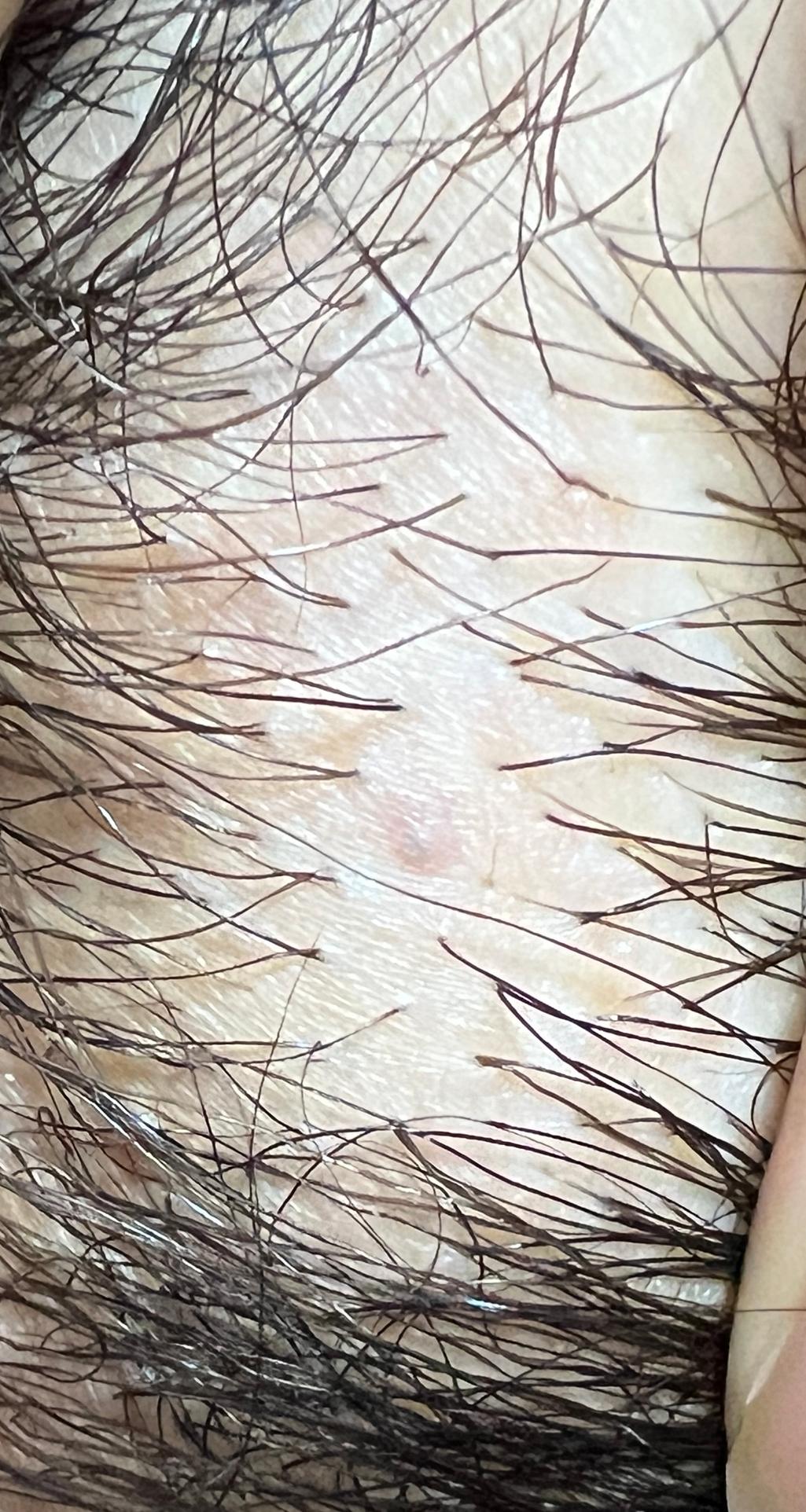 2번 째 사진