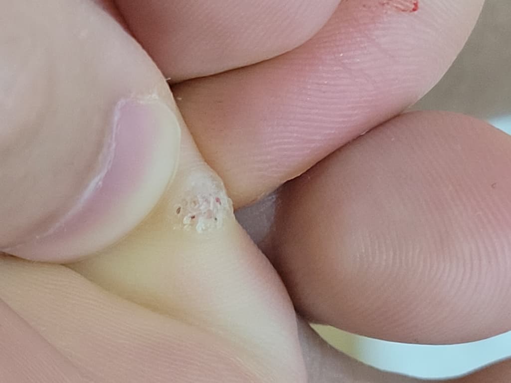 2번 째 사진