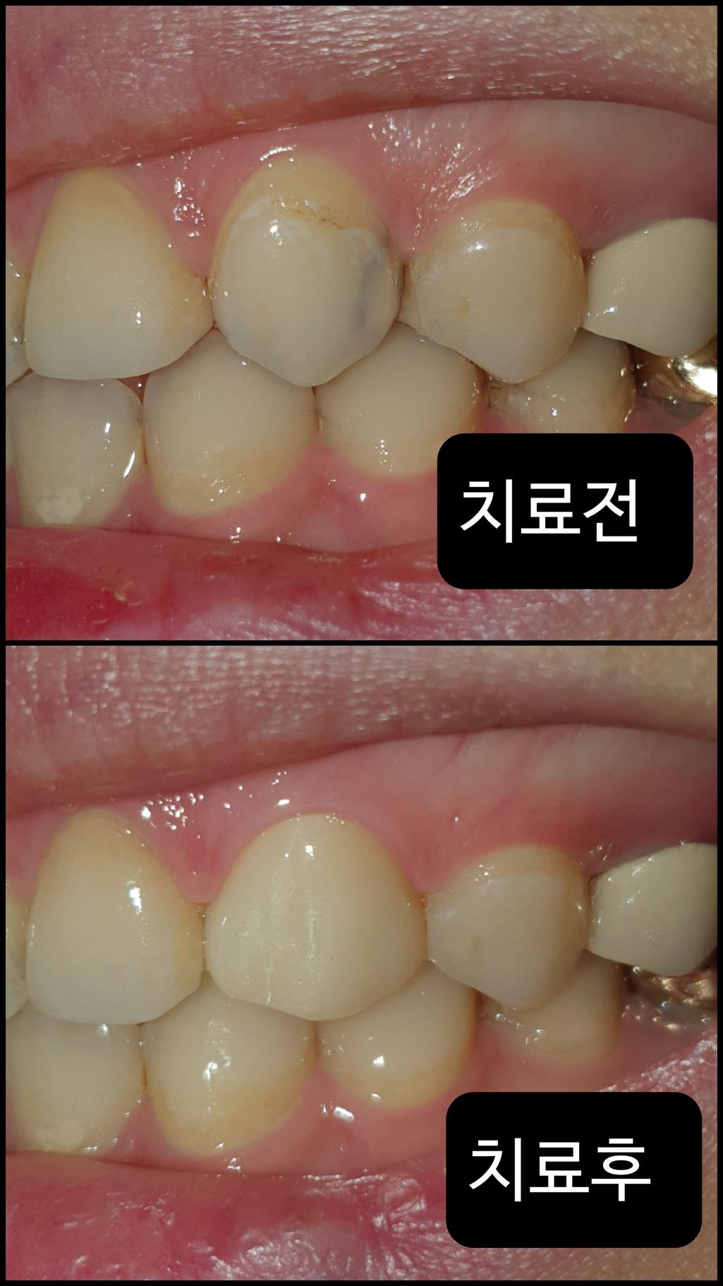 2번 째 사진
