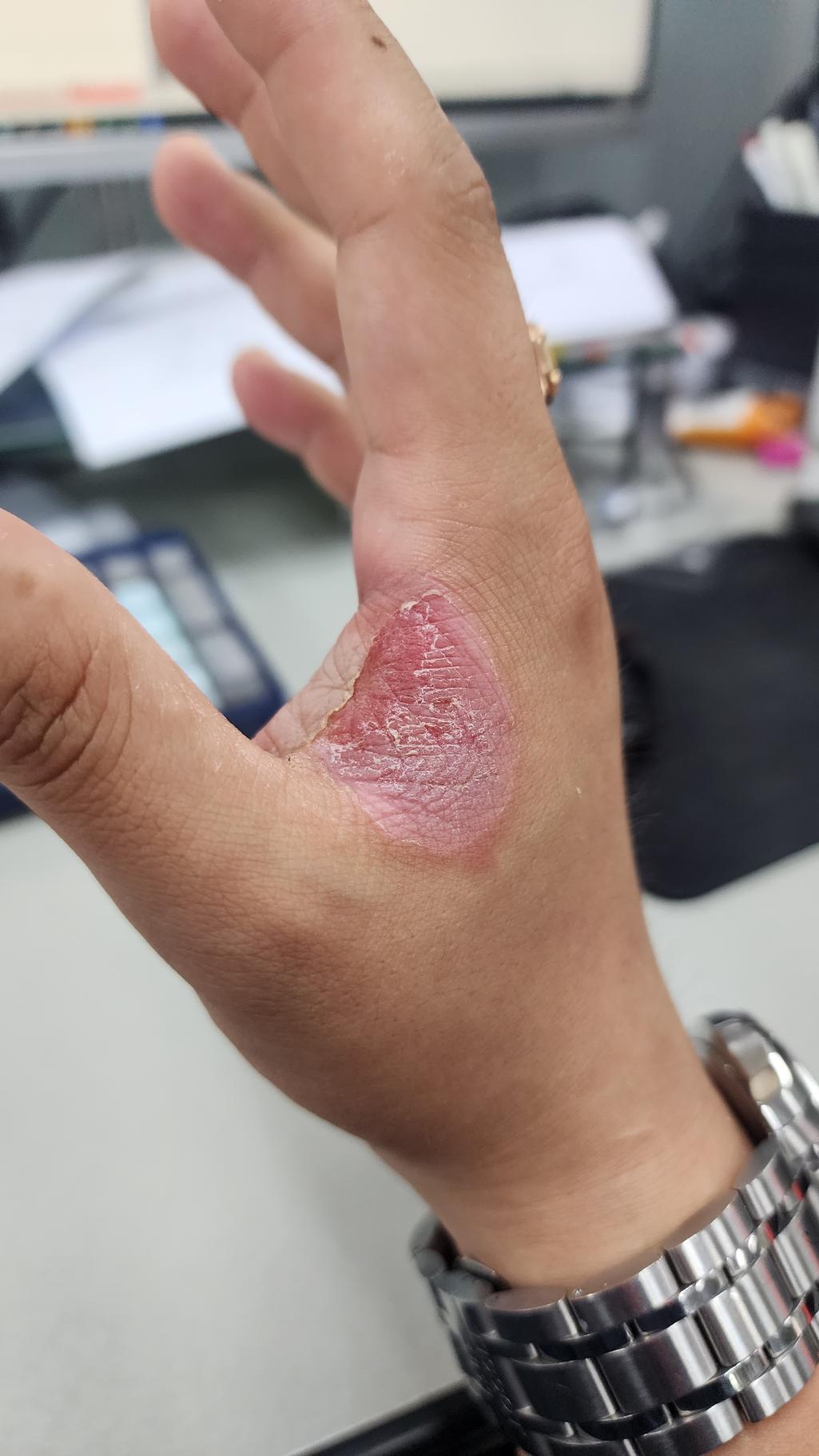 5번 째 사진