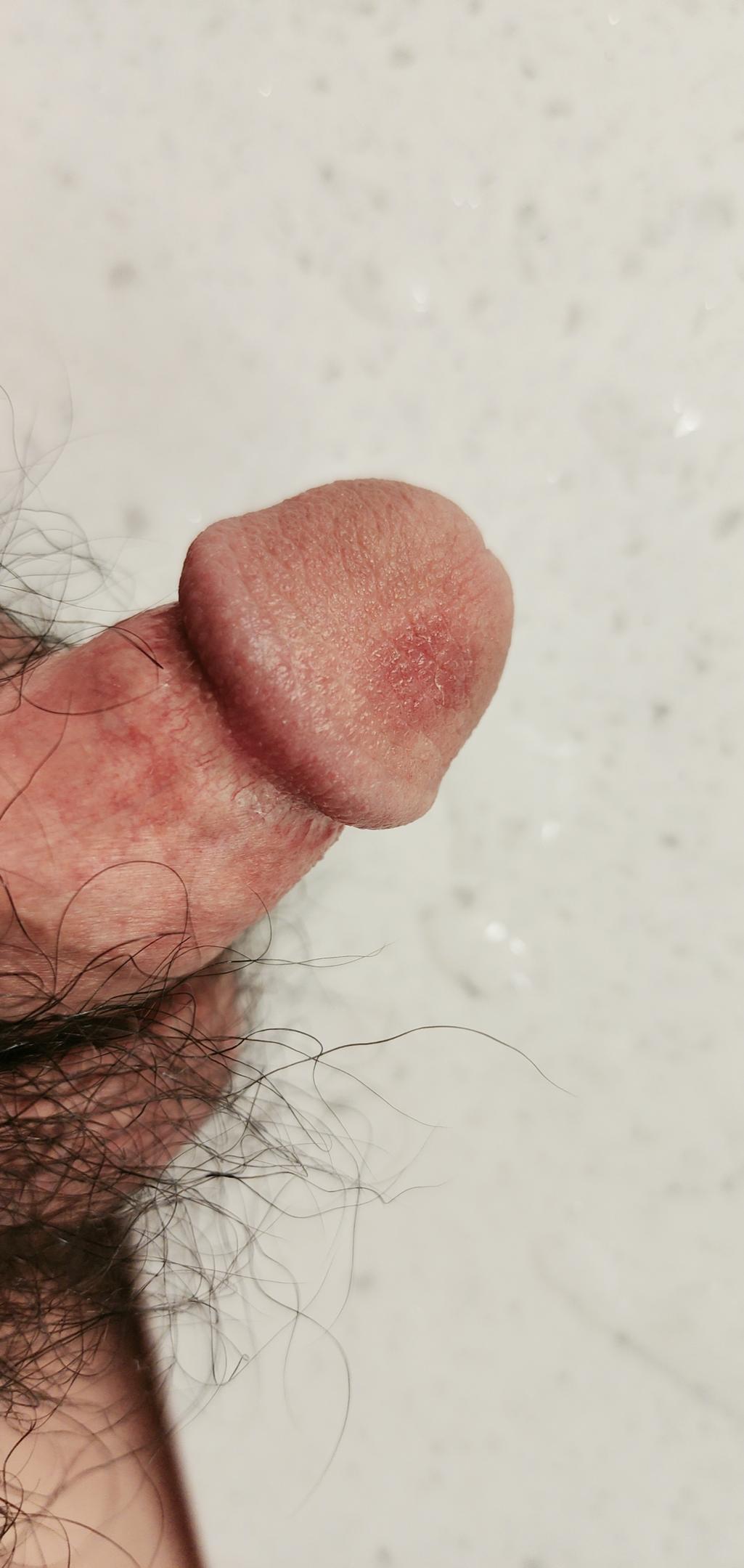 2번 째 사진