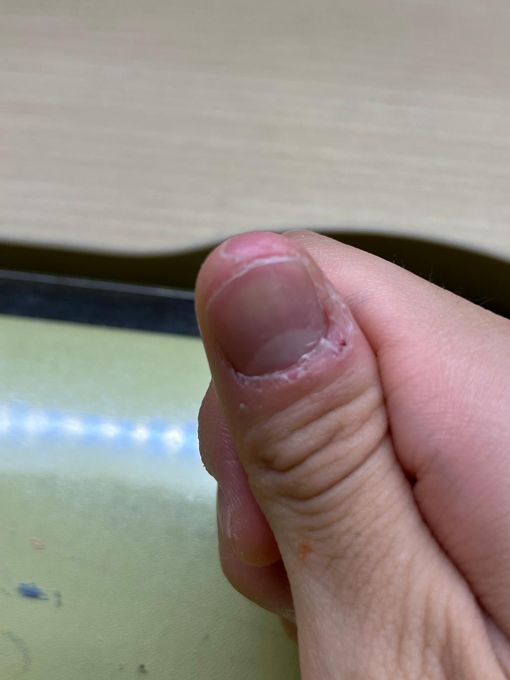 5번 째 사진