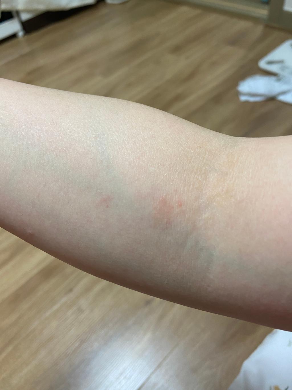 2번 째 사진