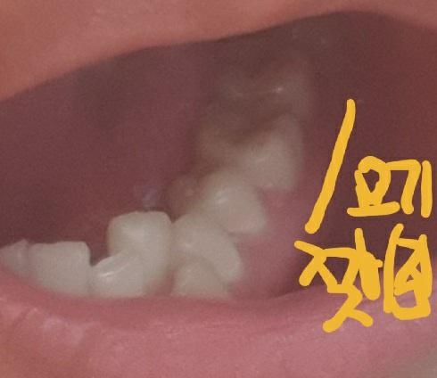 1번 째 사진