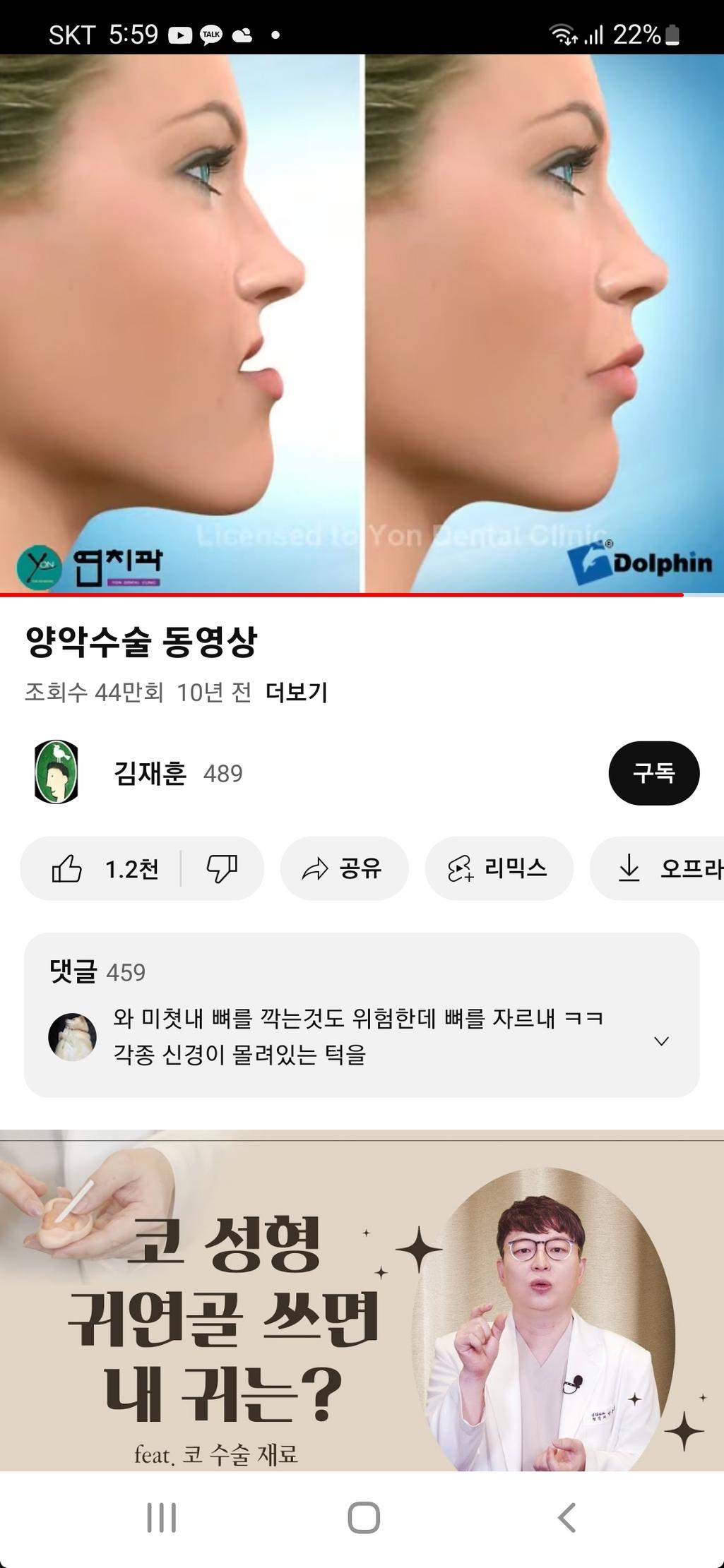 1번 째 사진