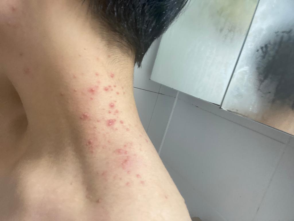 2번 째 사진