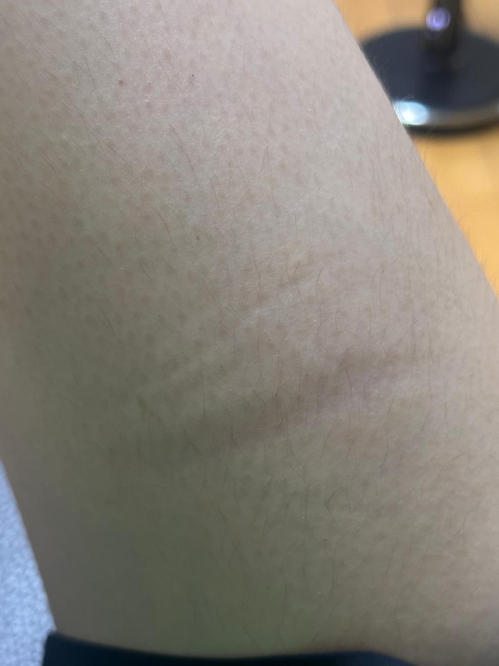 4번 째 사진