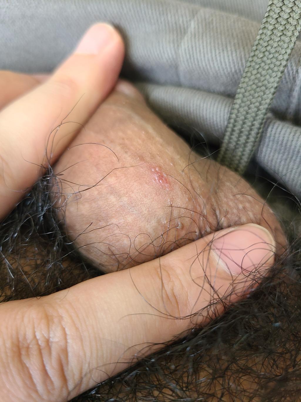 2번 째 사진