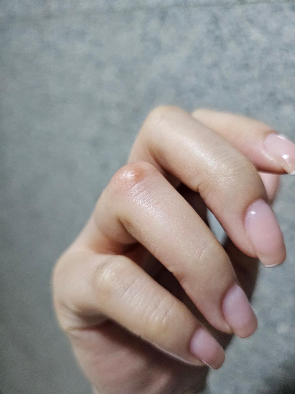 1번 째 사진