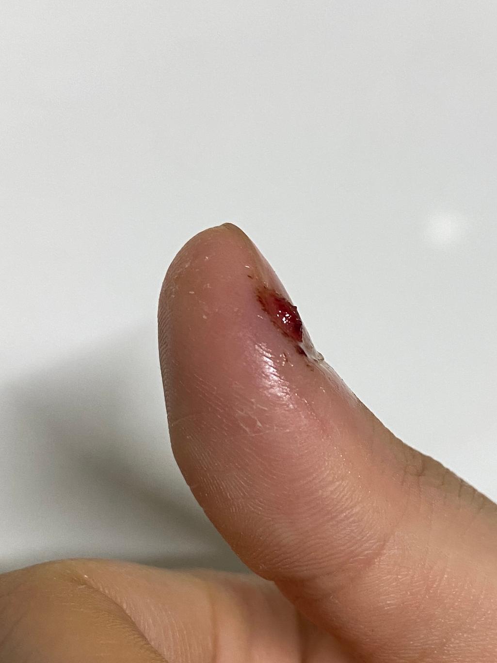 2번 째 사진