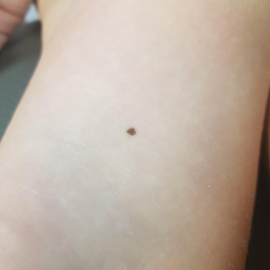 2번 째 사진
