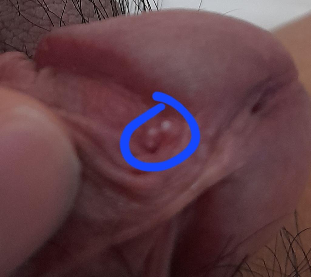 2번 째 사진