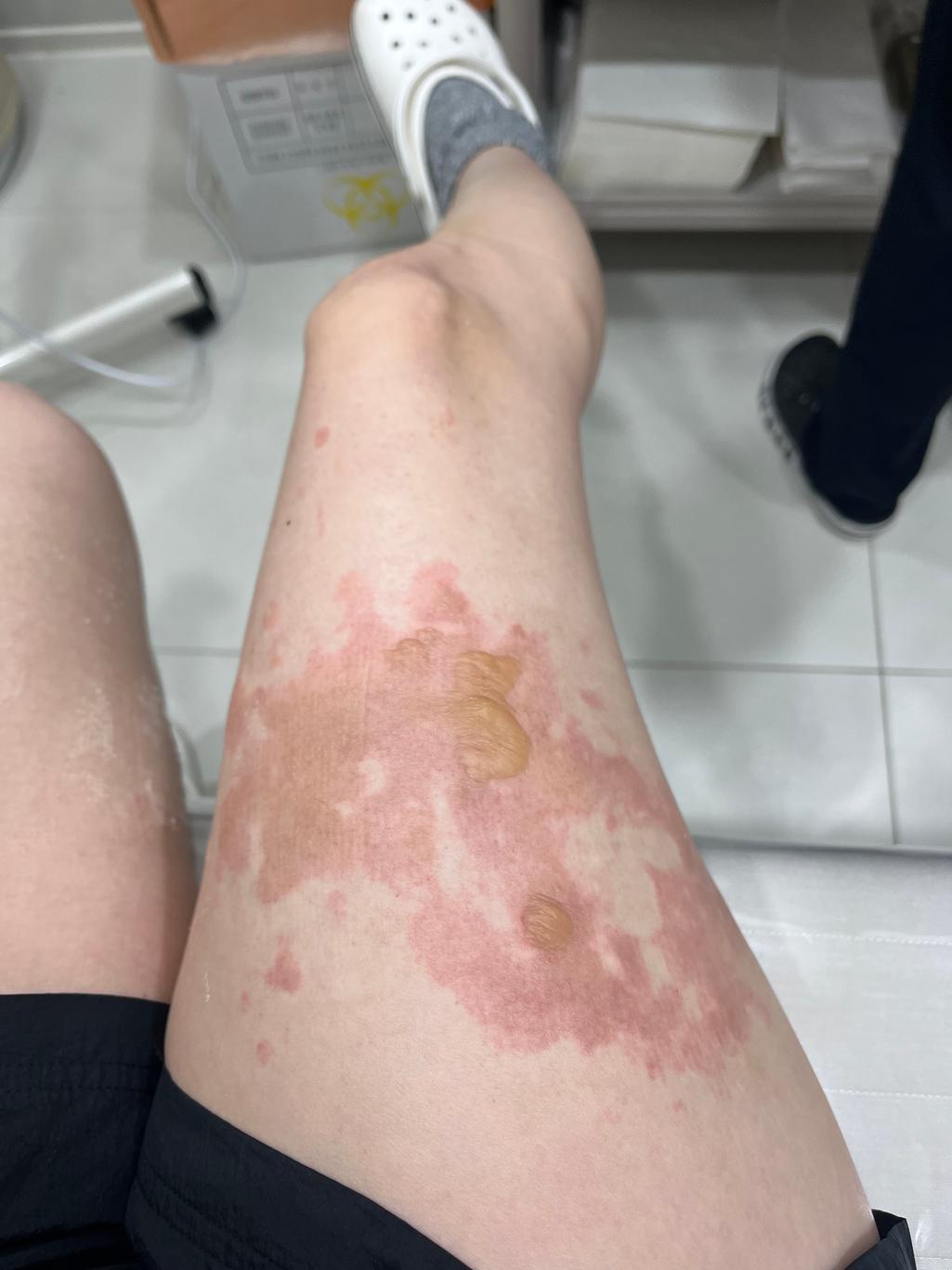2번 째 사진