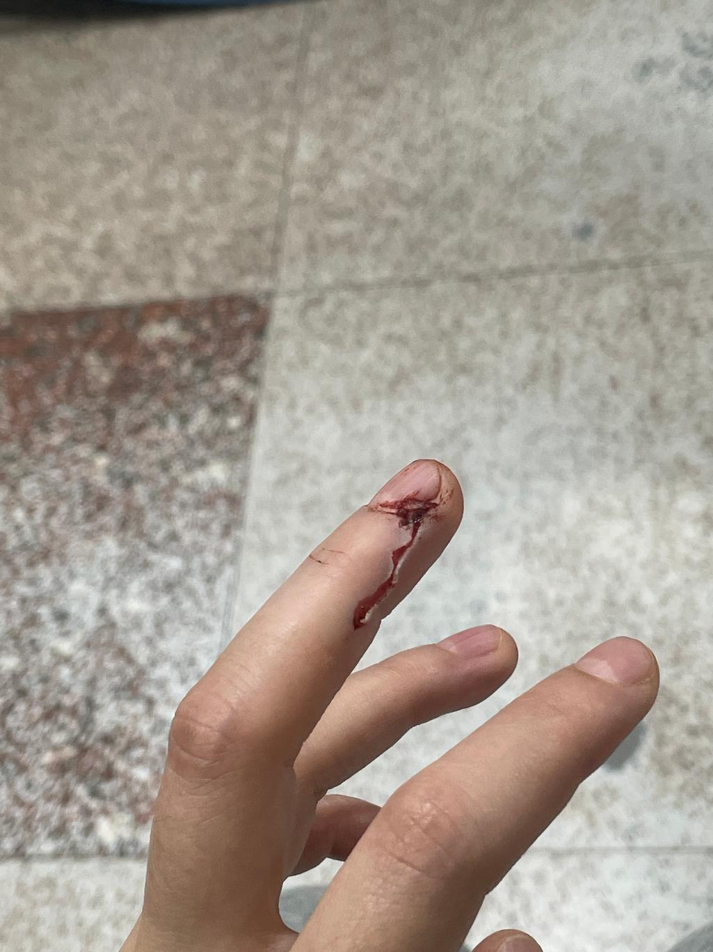 1번 째 사진