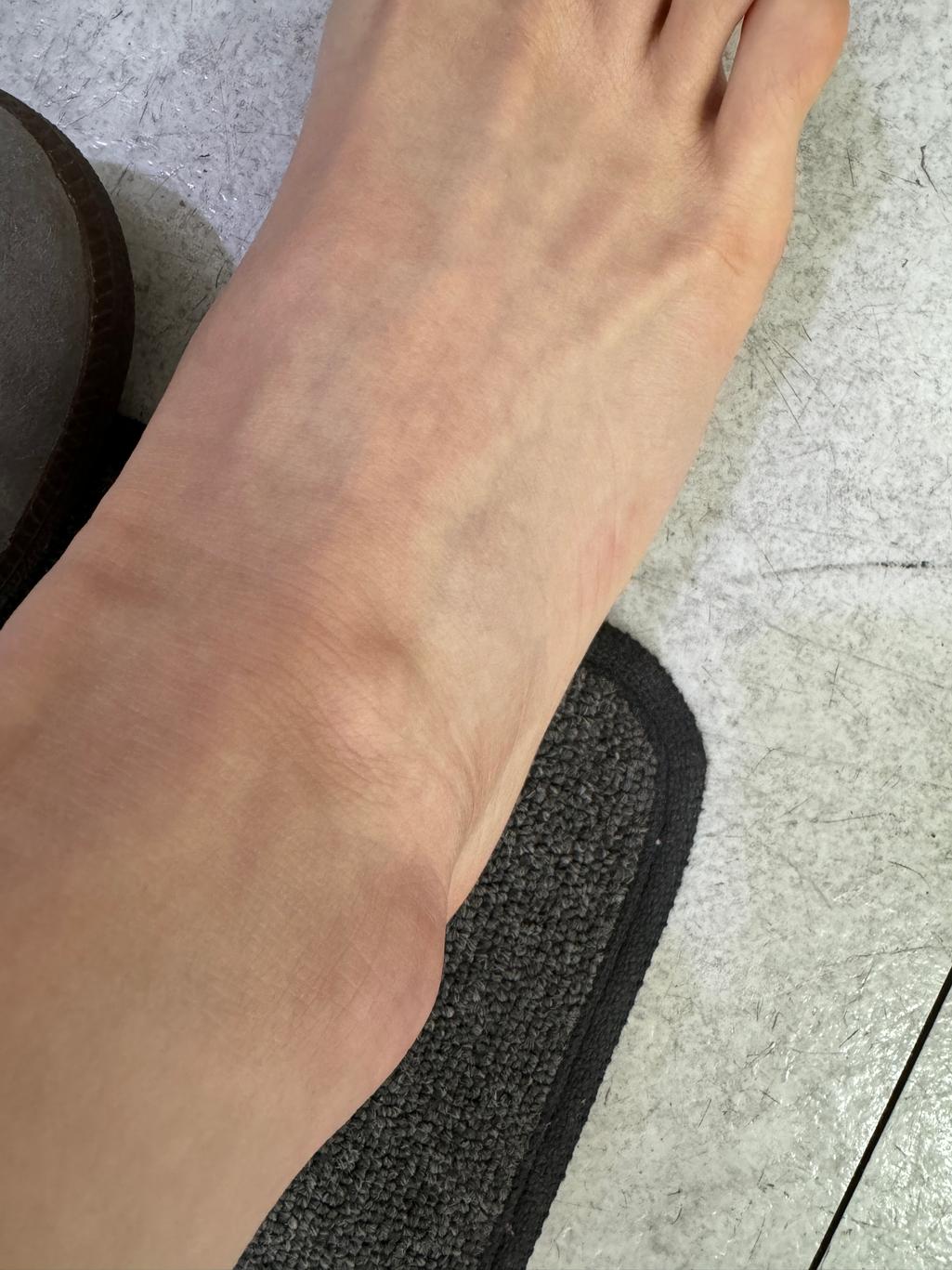 2번 째 사진