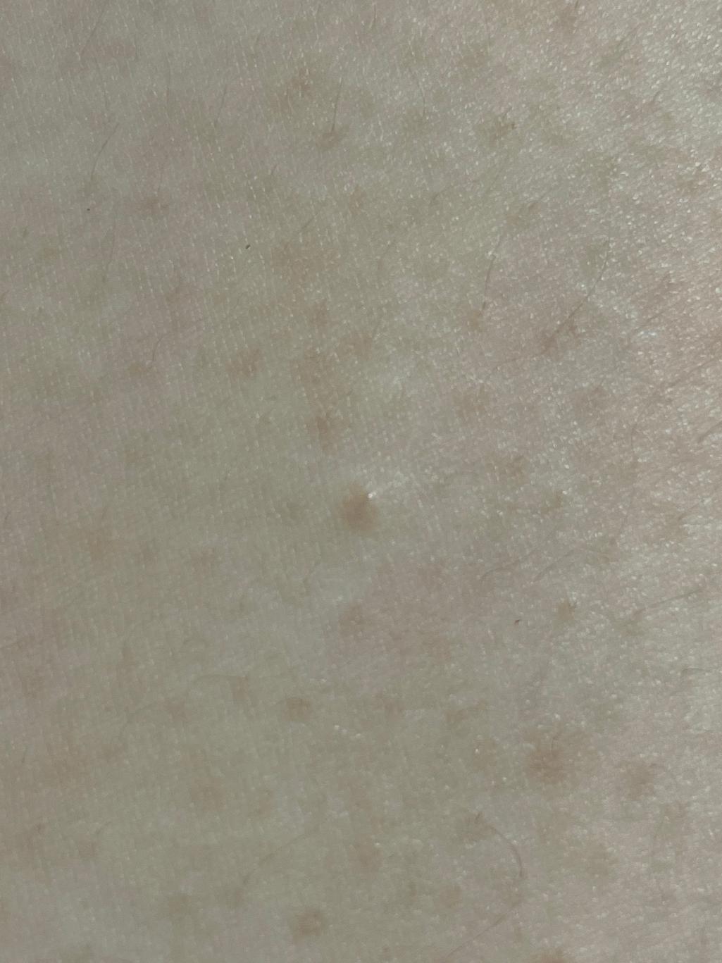 7번 째 사진
