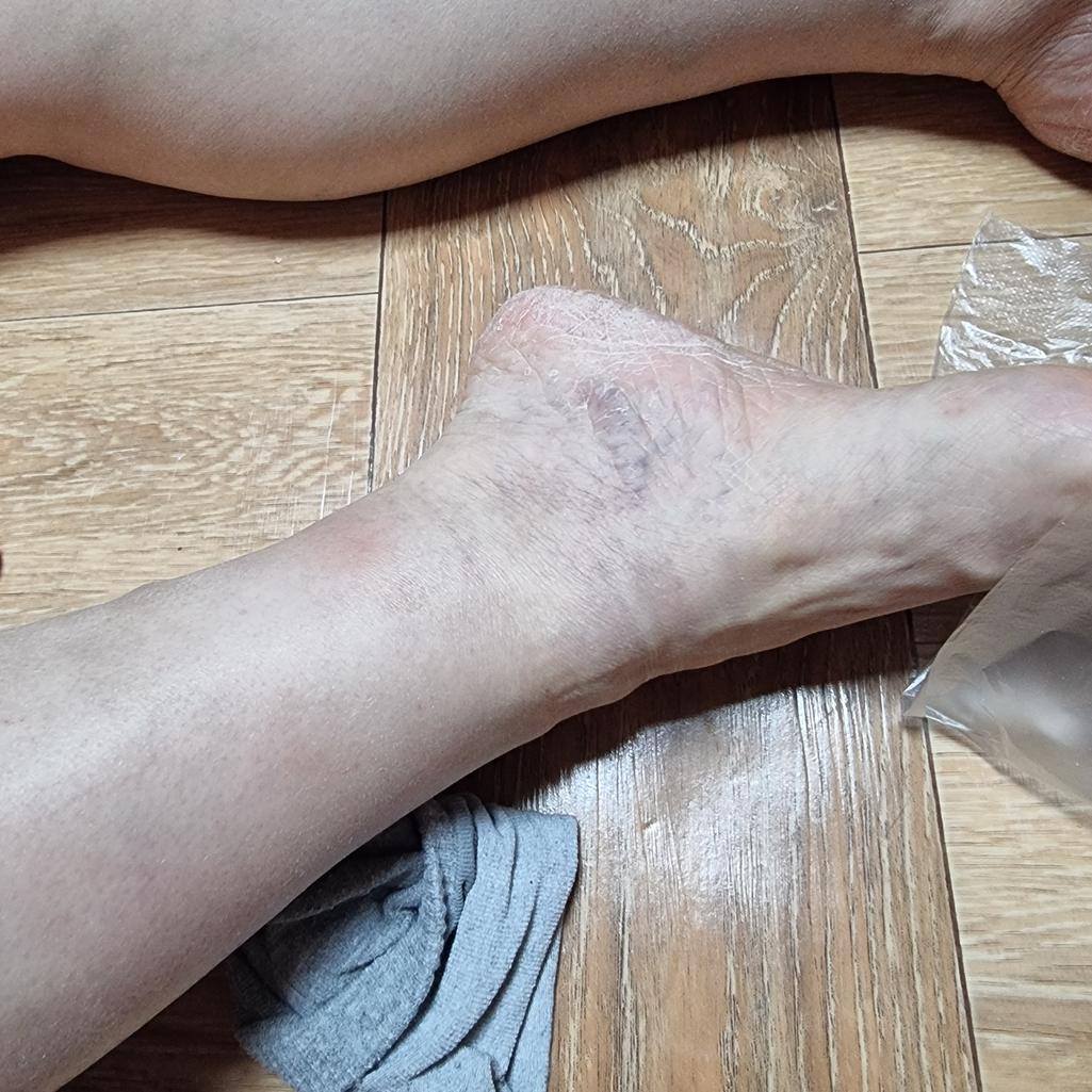 2번 째 사진