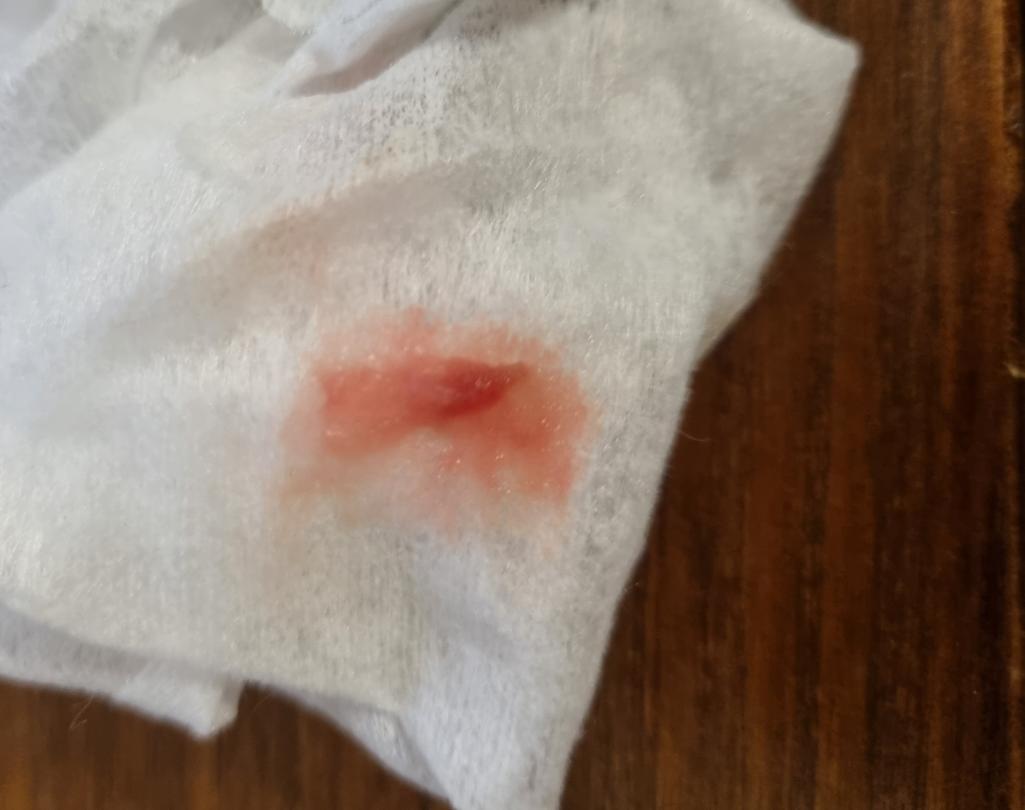 1번 째 사진