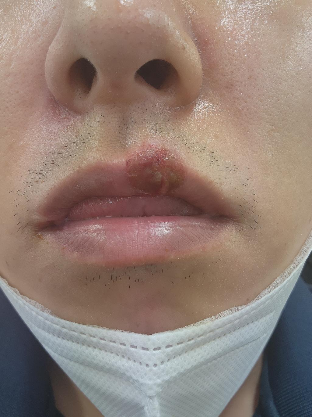 4번 째 사진