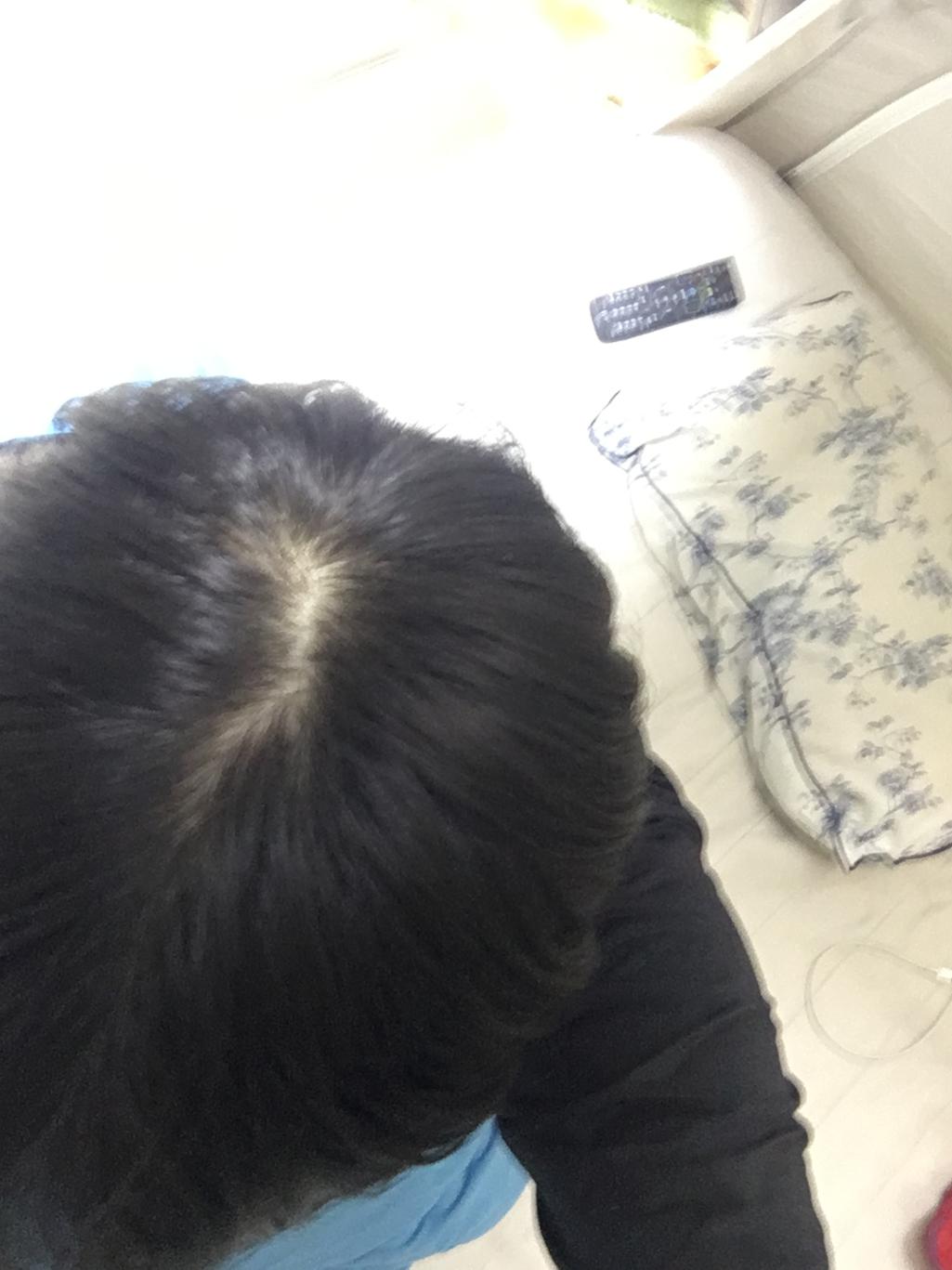 2번 째 사진