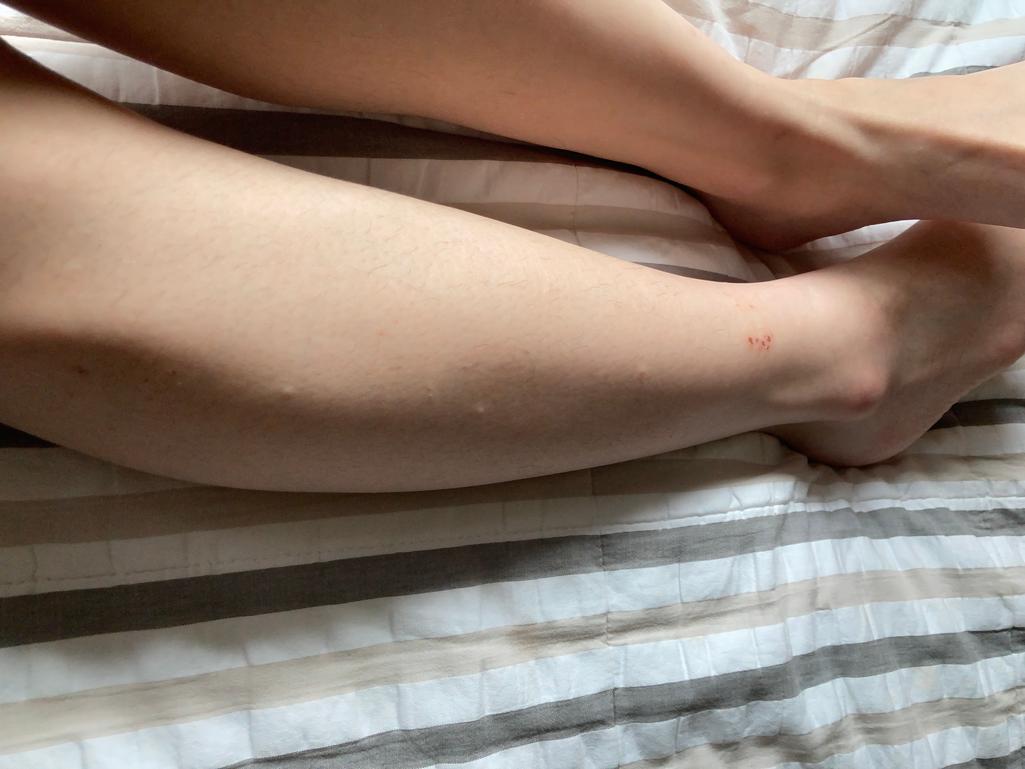 2번 째 사진