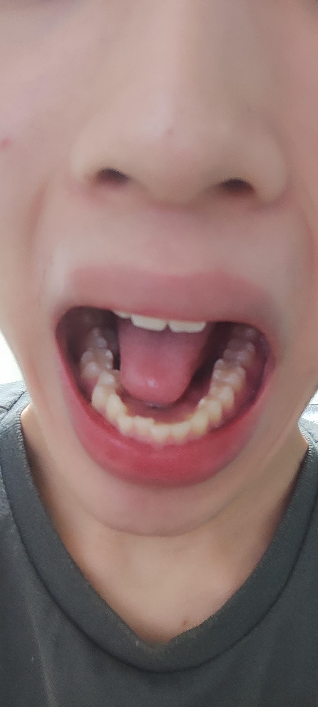 3번 째 사진