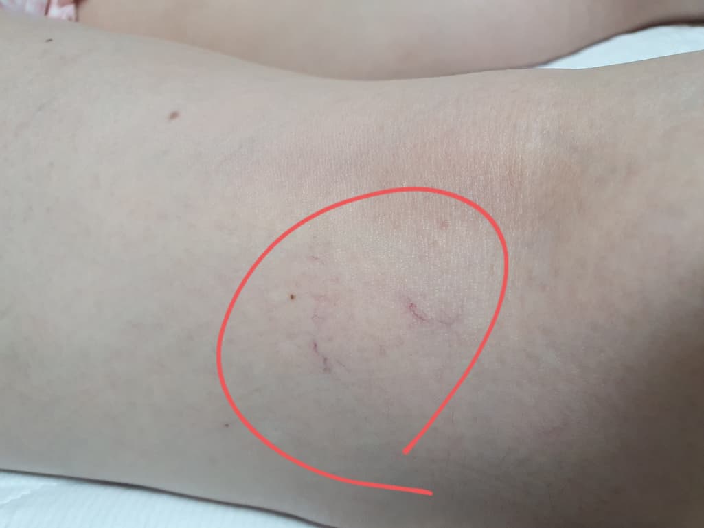 2번 째 사진