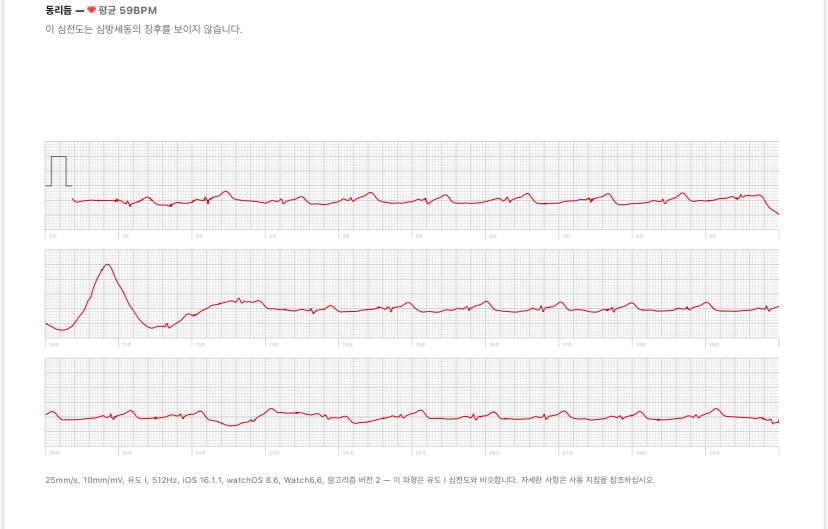 2번 째 사진