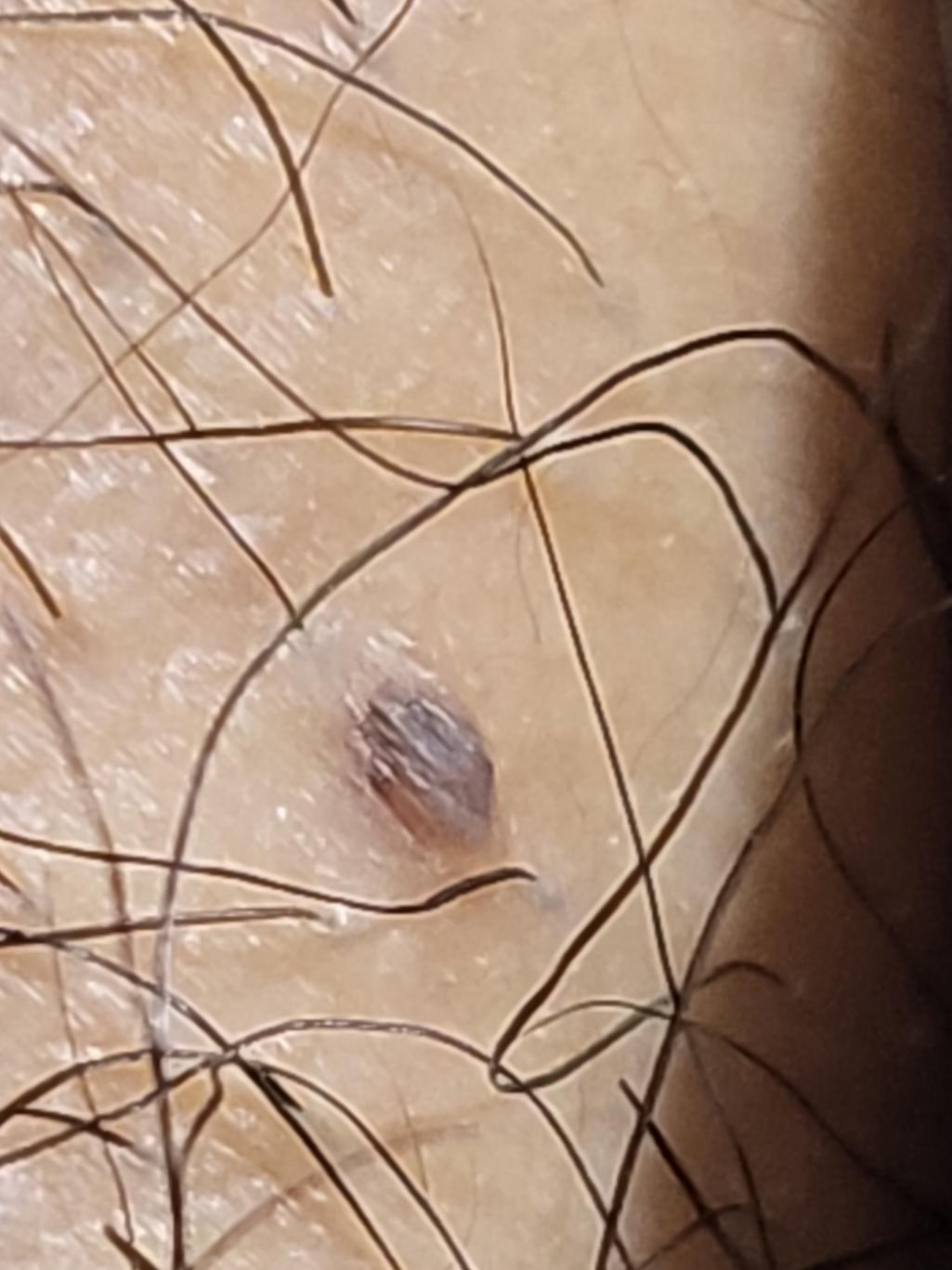 2번 째 사진