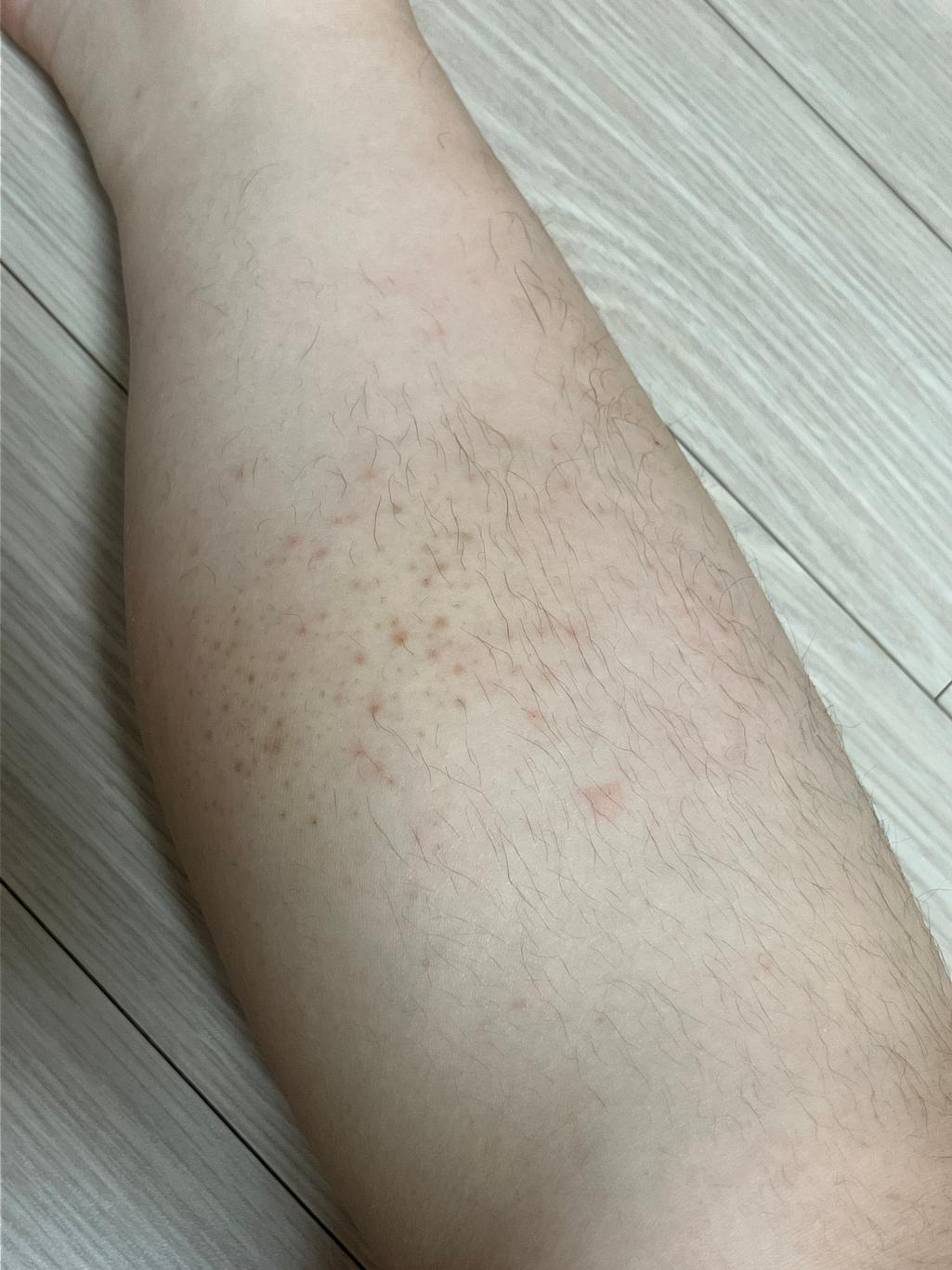 2번 째 사진