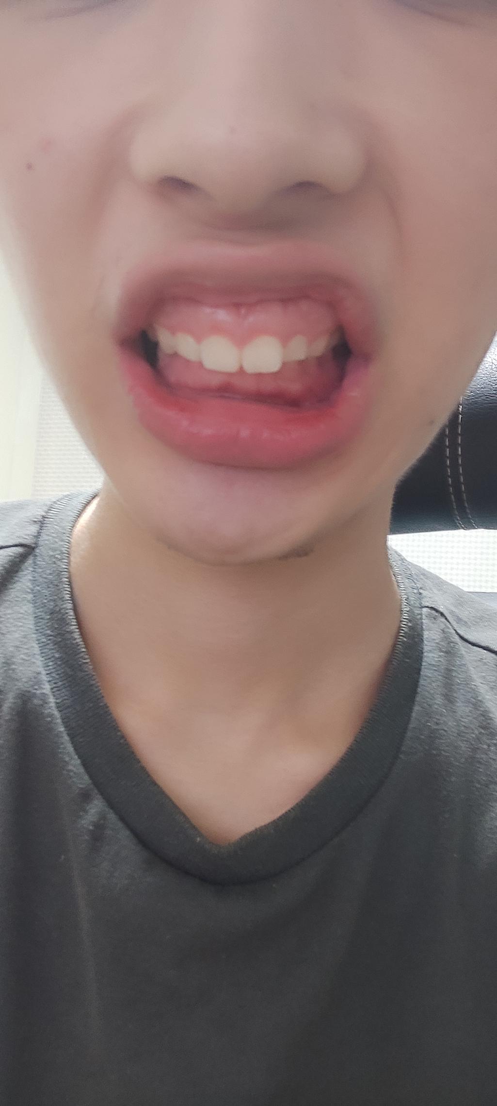 1번 째 사진