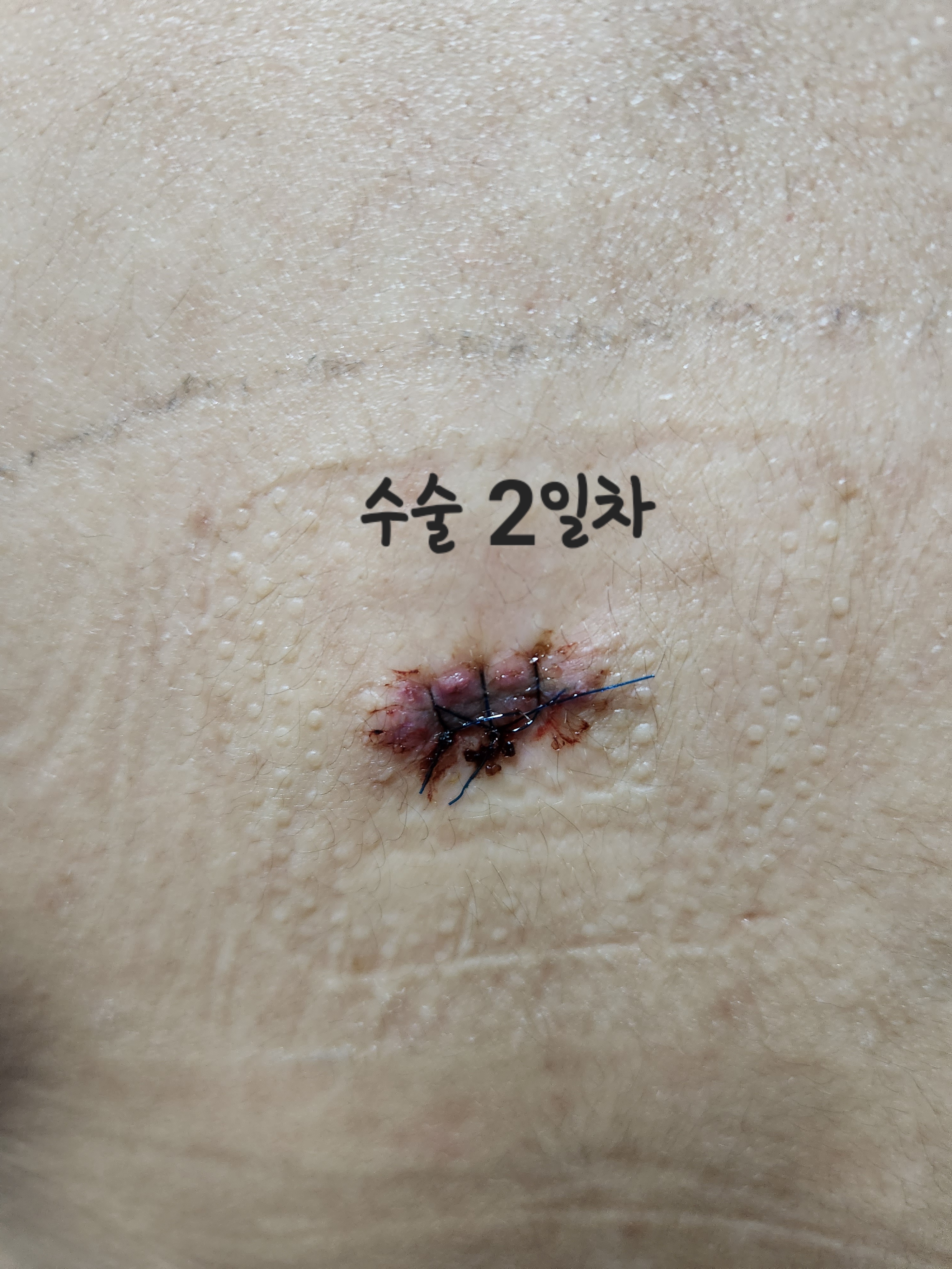 2번 째 사진