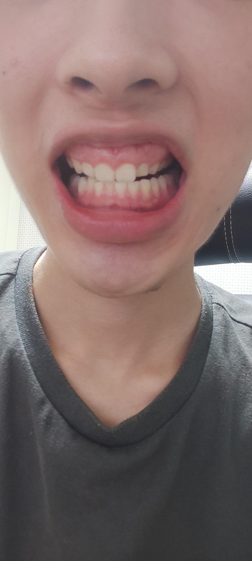 2번 째 사진