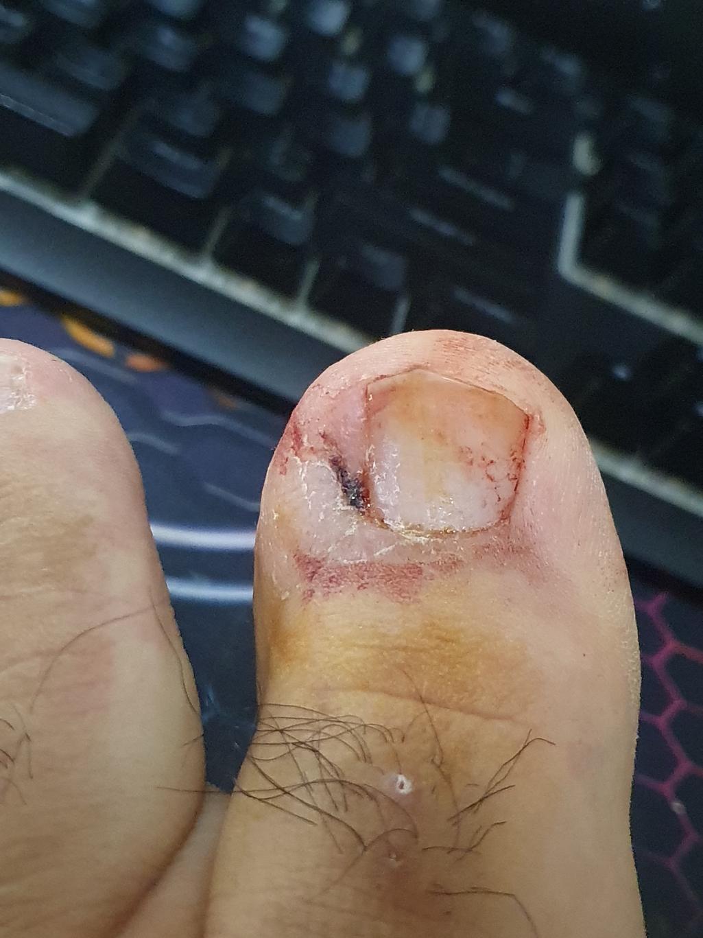 1번 째 사진