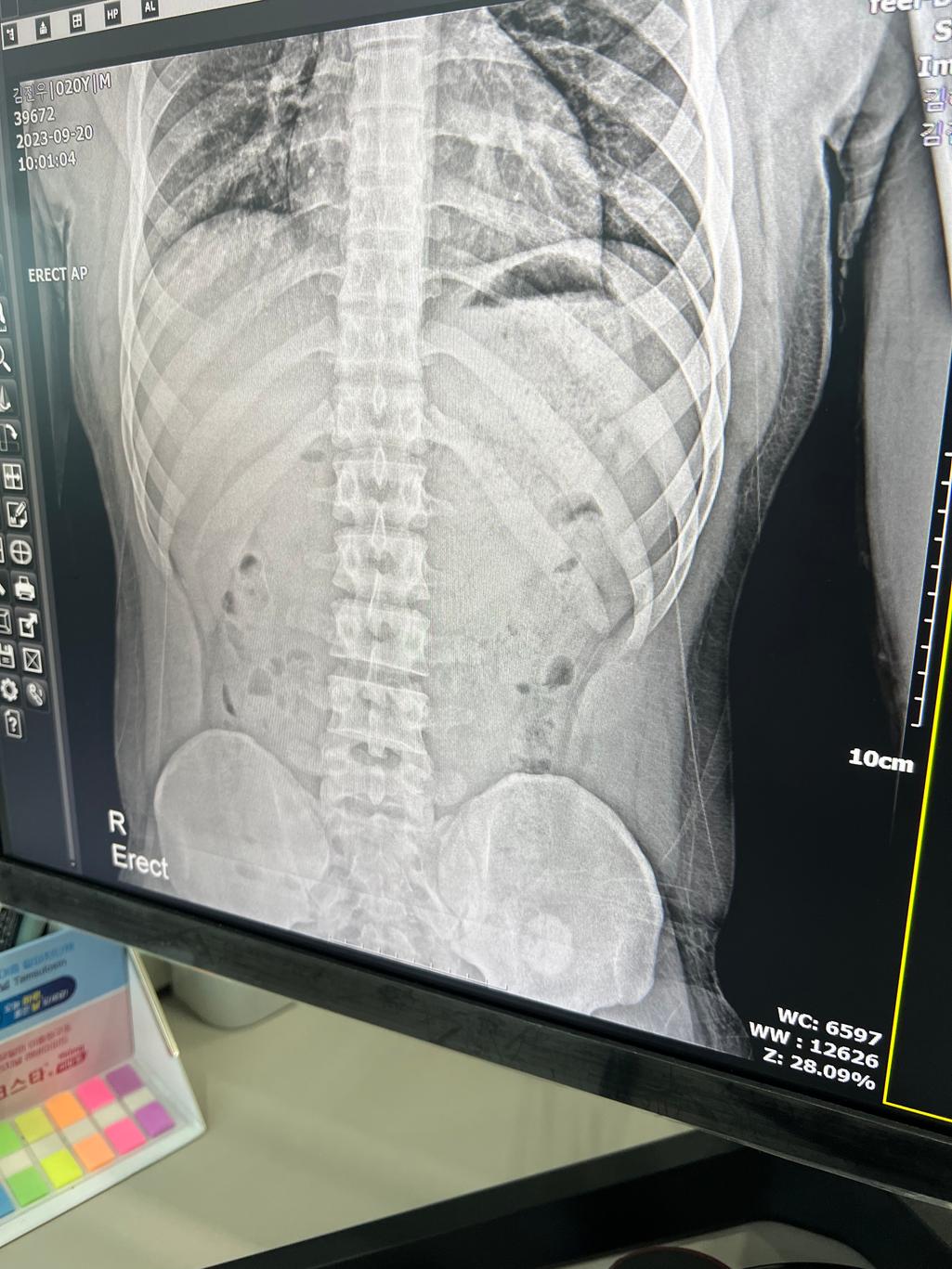 1번 째 사진