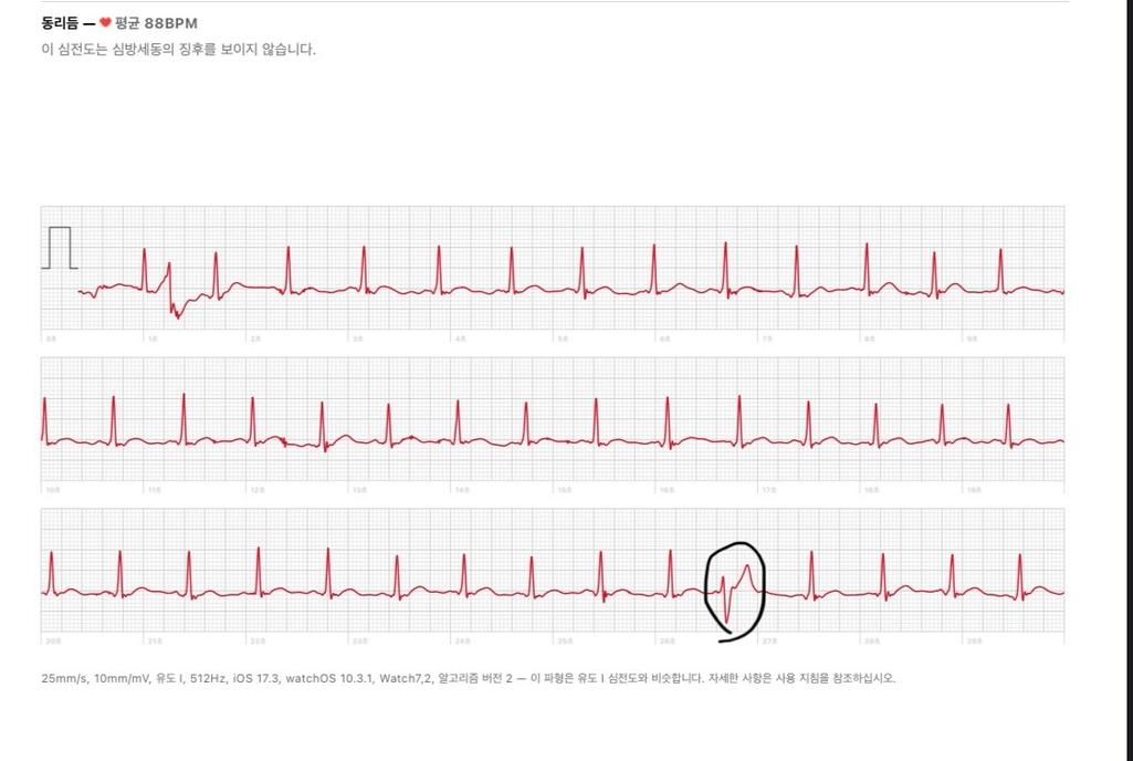 2번 째 사진