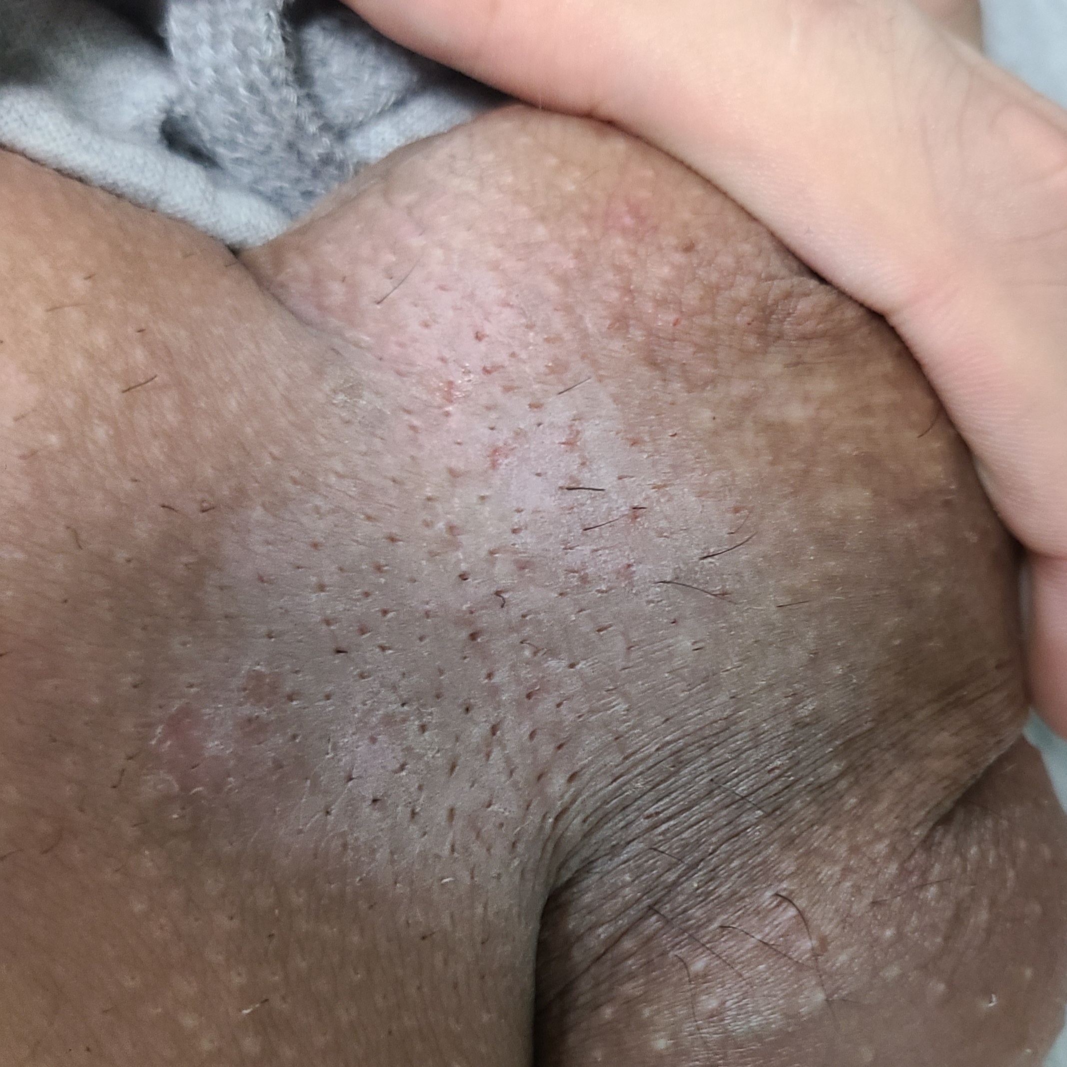 3번 째 사진