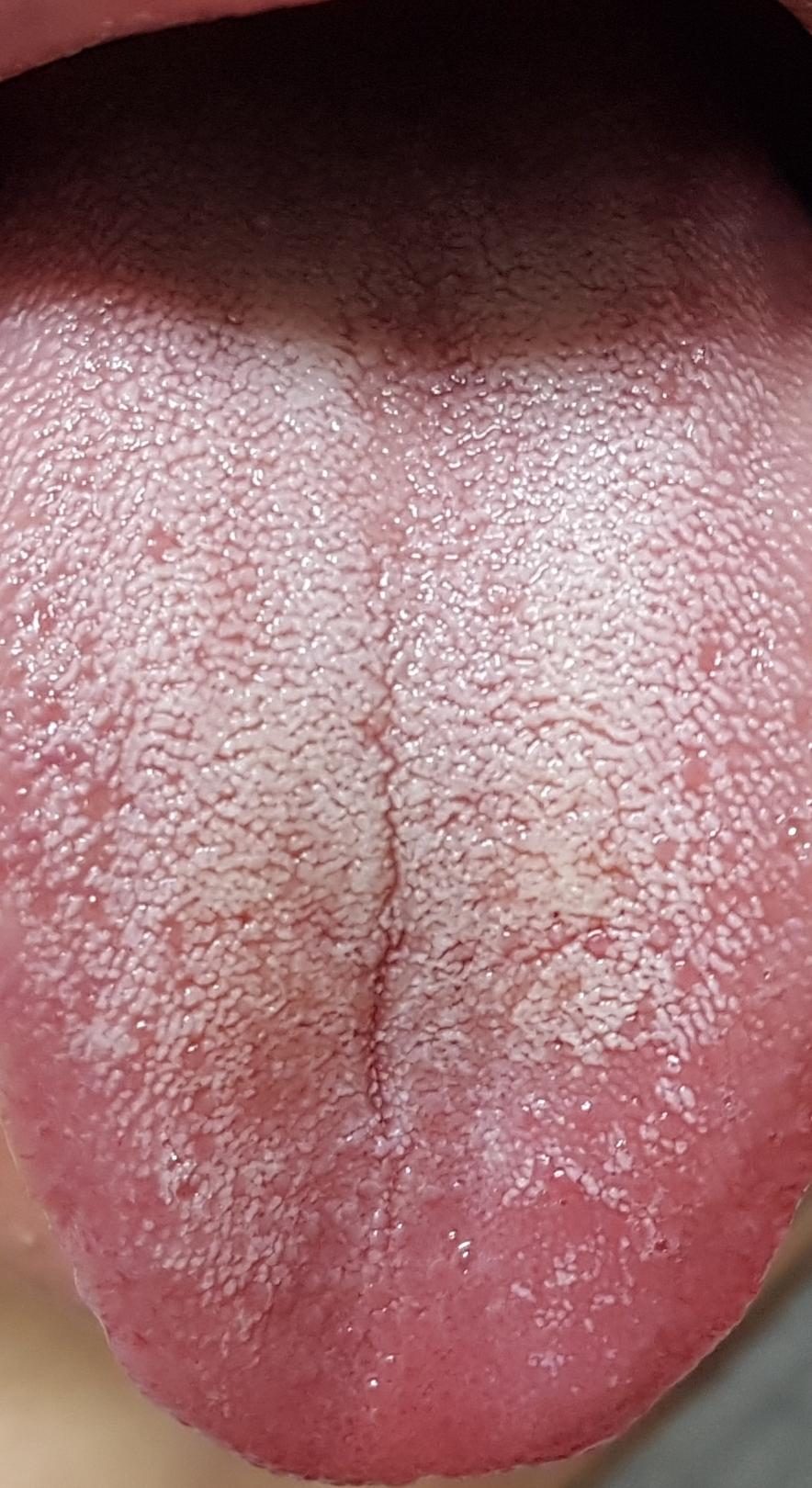 5번 째 사진
