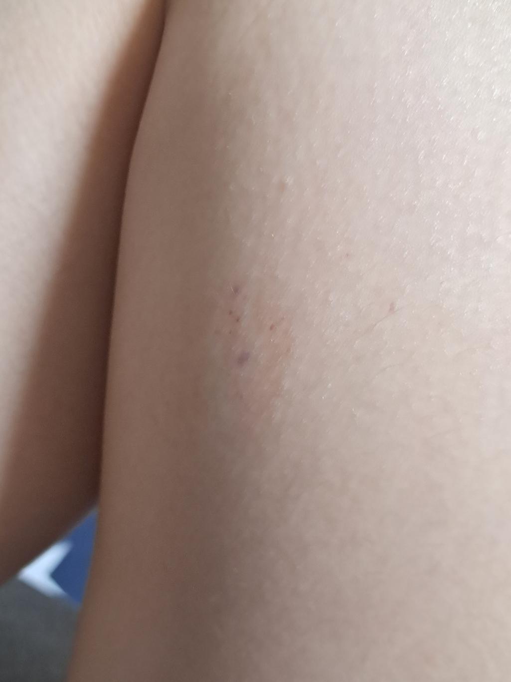 2번 째 사진