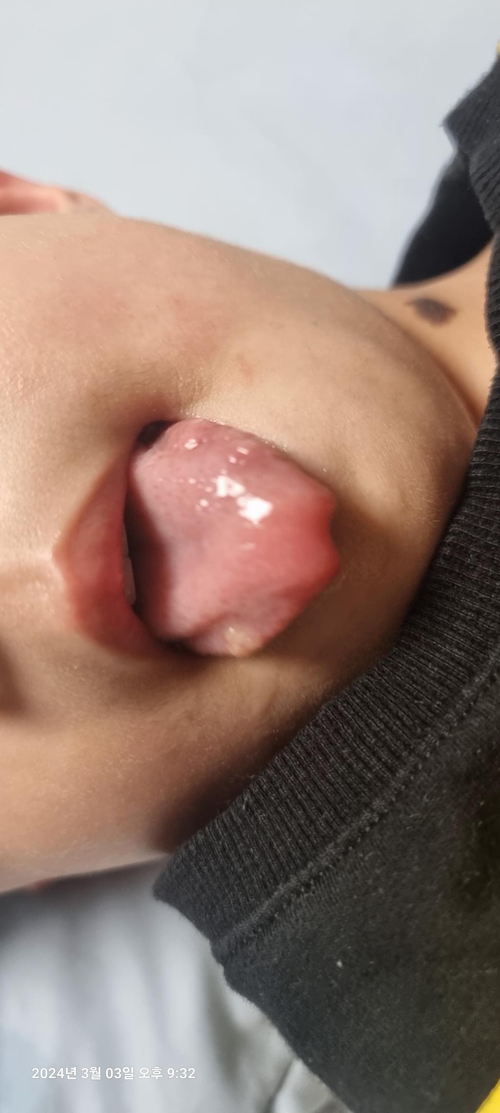 2번 째 사진