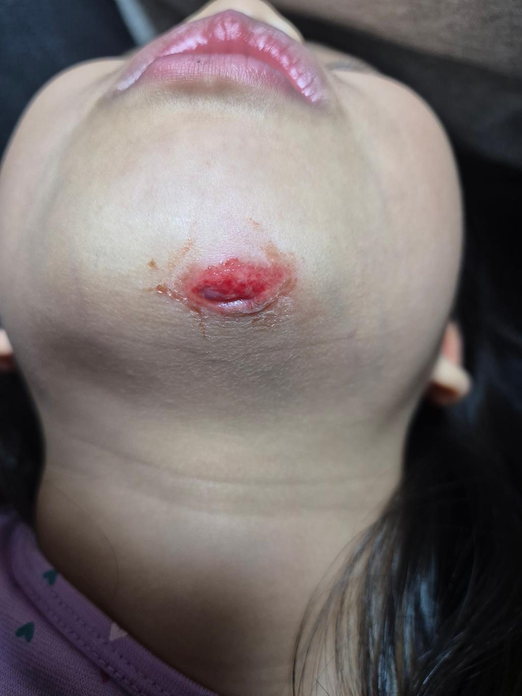 2번 째 사진