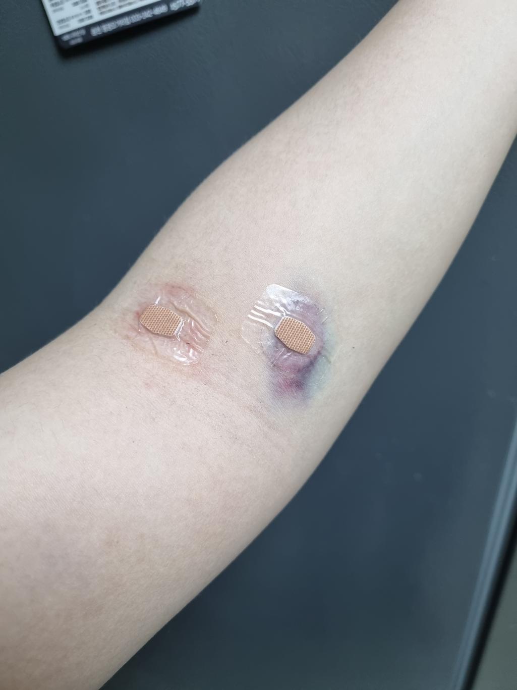2번 째 사진