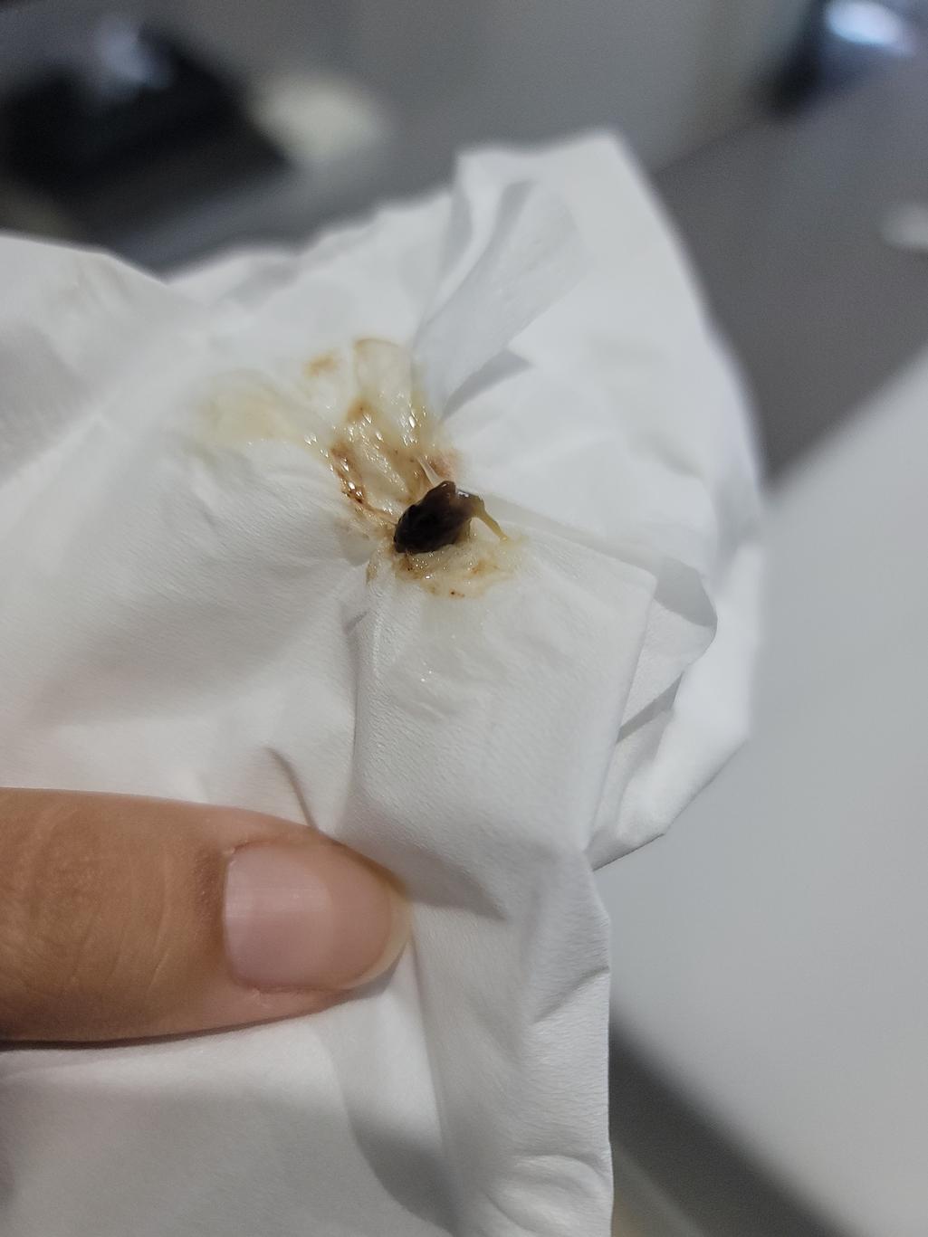 2번 째 사진