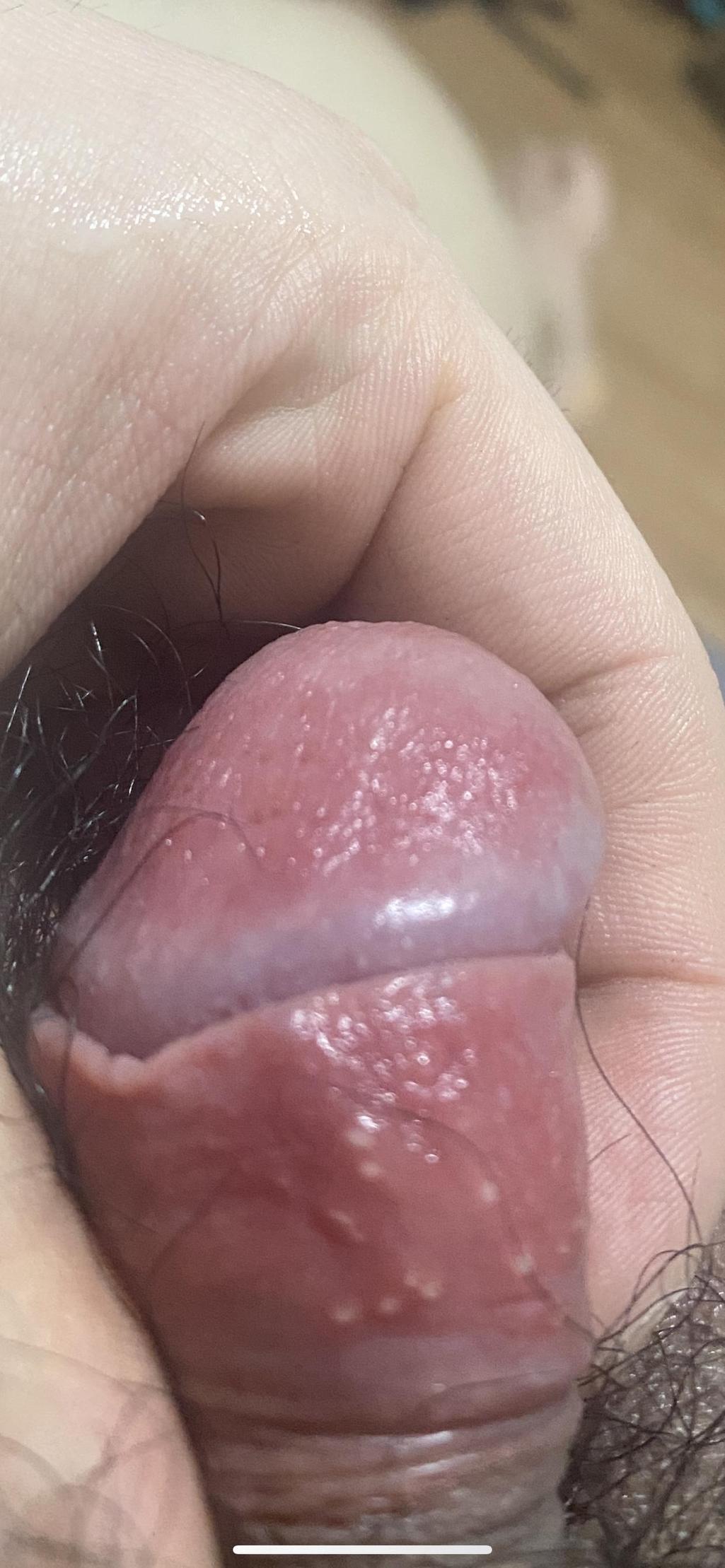 2번 째 사진