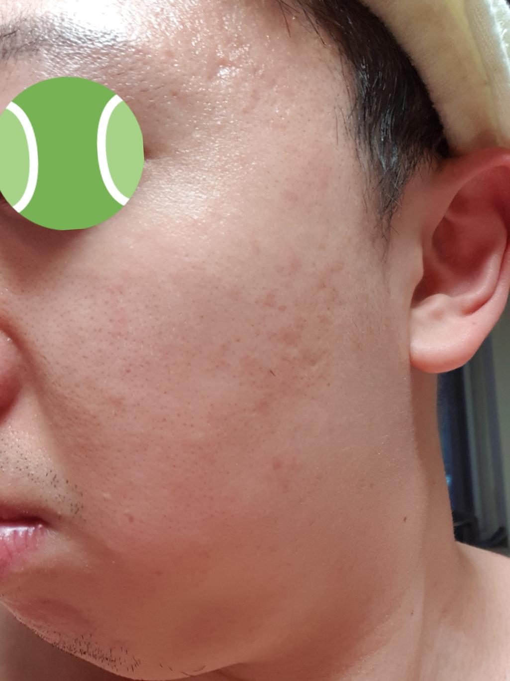 4번 째 사진