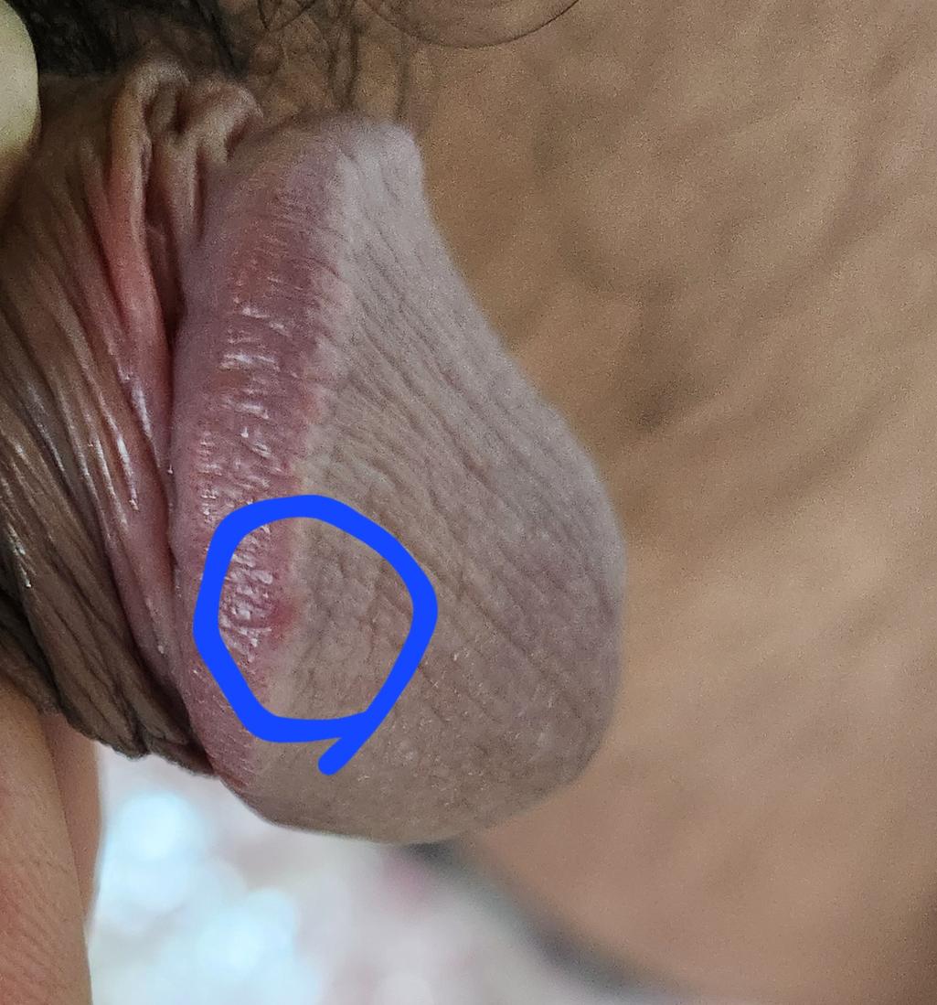 2번 째 사진